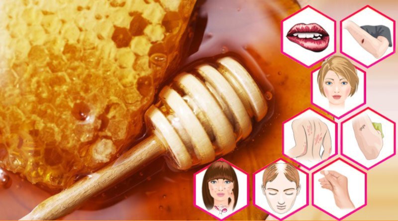 miele di manuka