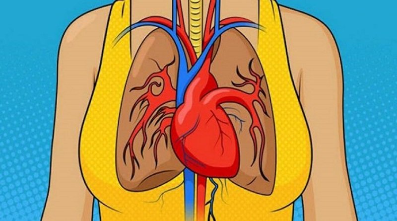 sintomi di infarto