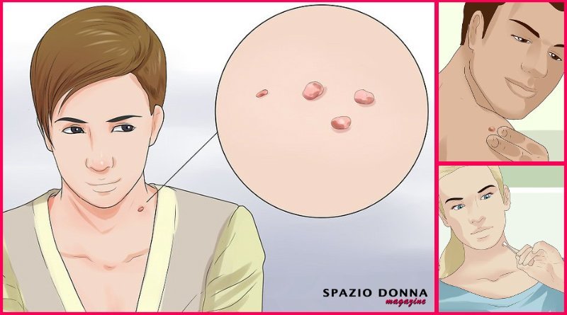 fibromi-penduli