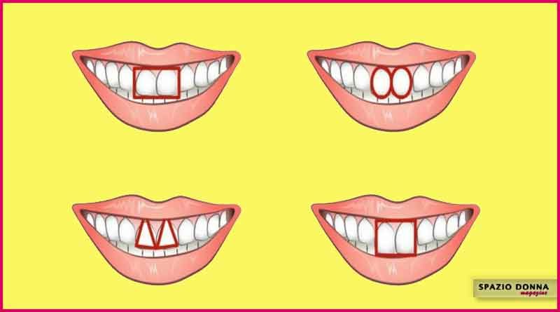 forma dei denti